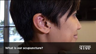 What Is Ear Acupuncture [upl. by Ebsen]