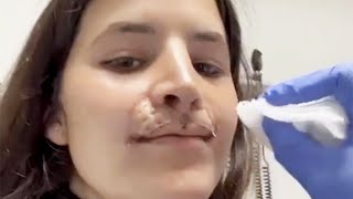 Pro Skater Brooklinn Khoury Shares Lip Reconstruction Progress 3 Years After Dog Attack [upl. by Kcim]