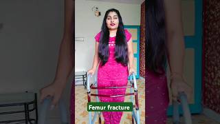 Femur fracture ki situation ki walking payallifecorner fracturevlog shorts femur [upl. by Ahsinik425]