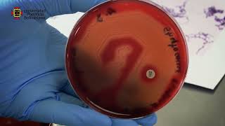 Infeccion bacteriana en la piel IMPÉTIGO Que es fisiopatologia y Tratamiento  Piodermitis [upl. by Seiber]