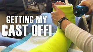 Getting My Cast Off  Broken Leg Fractured Fibula brokenleg cast [upl. by Avilys693]