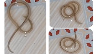 Ascaris lumbricoides 🥨 Round Worm 🪱  AschelminthesNematodes [upl. by Adianes197]