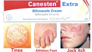 Canesten extra Bifonazole Cream uses [upl. by Ahsiak]