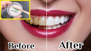 Teeth Whitening at Home in 2 Minutes teethteethwhiteningتبييضالاسنان [upl. by Adnamma]