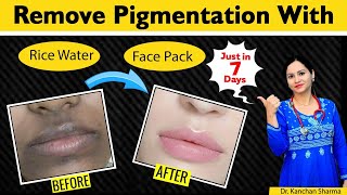 How To Remove dark Black PatchesDark Spots Pigmentation Around Mouth Area  Ask Health Guru [upl. by Riggs]