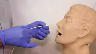 Nasogastric NG Tube Insertion OSCE Guide YouTube [upl. by Yecnay]