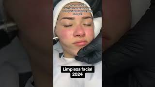 Limpieza facial profunda profesional  Paso a paso limpiezafacial [upl. by Nyrehtac446]