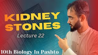 Kidney Stones  Disorder of Kidneys  How to Treat the kidney stones  Lecture 22 [upl. by Eilah]