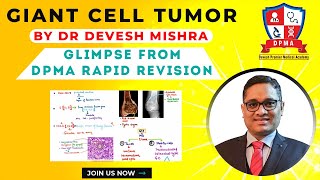 quotGiant cell Tumor quotBy Dr Devesh Mishra Glimpse from “DPMA Rapid Revision Pathology course” [upl. by Leon]