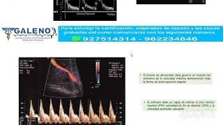 🔴 CURSO TÉCNICAS Y PROTOCOLOS DE ECOGRAFÍA DOPPLER FETAL [upl. by Bortz546]