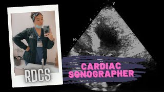 Cardiac Sonography [upl. by Yeltihw684]