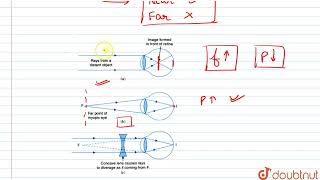 Draw a ray diagram to show a myopic eye  CLASS 8  LIGHT3 OPTICAL INSTRUMENTS  PHYSICS  Dou [upl. by Aneelad678]