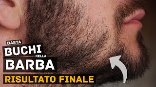 Buchi nella Barba Copenhagen Grooming TEST FINALE  Parte 4 [upl. by Surdna]