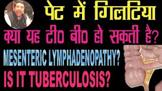 Mesenteric Lymphadenopathy Causes and Treatment Glands in Abdomen Lymph Nodes in Abdomen [upl. by Hcirteid]