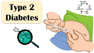 Type 2 Diabetes  Causes Risk Factors Signs amp Symptoms Treatment  Everything You Need To Know [upl. by Oirtemed32]