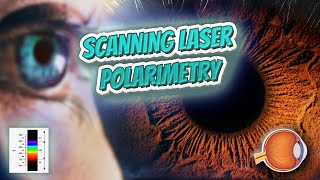 Scanning laser polarimetry Your EYEBALLS 👁️👁️💉😳💊🔊💯✅ [upl. by Eerpud]