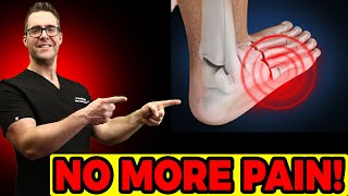 Hairline Stress Fracture in the Foot Symptoms amp Best TREATMENT [upl. by Atnuahs]