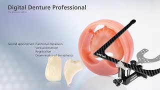 Digital Denture – second Appointment [upl. by Derayne]