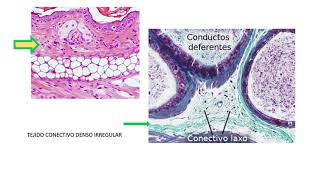 TEJIDO CONECTIVO CORTES HISTOLÓGICOS [upl. by Ermey]