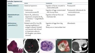 PARASITOLOGY USMLE [upl. by Hacim199]