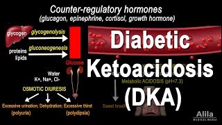 Diabetic Ketoacidosis DKA Pathophysiology Animation [upl. by Eustazio]