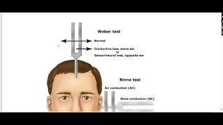 Audiometry and Audiogram [upl. by Avle839]