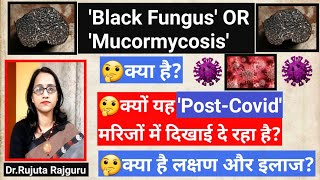 Mucormycosis Symptoms in HindiPost Covid patientsBlackFungus disease kya hai ब्लैक फंगस क्या है [upl. by Nnod136]