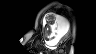 Foetal Development Unborn Baby Movement at 24 Weeks  WIRED [upl. by Windzer]