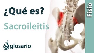 SACROILEITIS  ¿Qué es [upl. by Dnomso432]