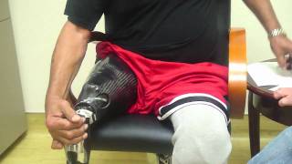 Amputee dons Stan Patterson NPS Elevated Vacuum Above Knee Socket Tutorial [upl. by Attenor]