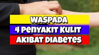 4 Penyakit Kulit Gatal Gatal yang diakibatkan Gula darah tinggi Diabetes DoctorAW 01 [upl. by Okimat759]