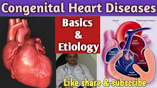 Basics of Congenital Heart Diseases  CHD [upl. by Alysoun]