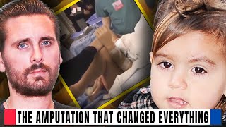 Scott Disick and Mason Discuss Life After Amputation [upl. by Nallaf]