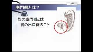 腹腔鏡下幽門側胃切除術とは？をわかりやすく。 [upl. by Yentuoc]