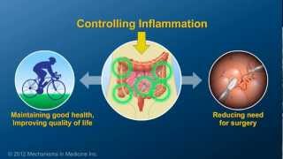 Chronic Inflammation in IBD and How AntiTNF Therapy Works [upl. by Ydnat300]