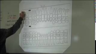 DATV Periodontal Charting [upl. by Harac]