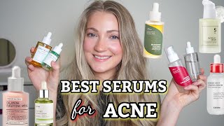 Best Korean Skincare Serums For Acne [upl. by Nylireg]