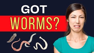 SNEAKY PARASITE SYMPTOMS  How To Avoid THESE Parasite Cleanse Reactions 😱  Robin Foroutan [upl. by Lait]