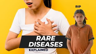 Rare Diseases Explained in Hindi  Current Affairs [upl. by Dianna]