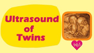 Sonography of Twins [upl. by Denna]