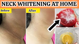 INSTANT NECK WHITENING AT HOME  Get rid of Dark Pigmented Neck In just 5 Minutes  Neck Whitening [upl. by Enaamuj]