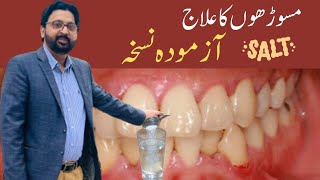 How to SWISH with SALT WATER to Cure Gum Disease Receding Gums and Gingivitis [upl. by Rehpotsirhcnhoj]