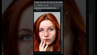 Remove Red Patches from Skin in Photoshop shorts [upl. by Nnep462]