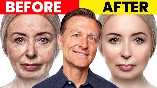 The Ultimate Face Transformation–Dr Bergs Best Remedy for Dry Skin and Wrinkles [upl. by Ettenauq]