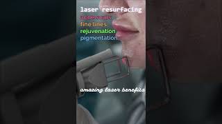 Never Hide Again Co2 Laser Acne Scar Remedy [upl. by Weitman]