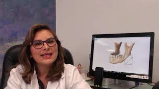 Perfilación maxilofacial y facial  Aumento Ángulo Mandibular  Dra Sandra Nieto [upl. by Rollo38]