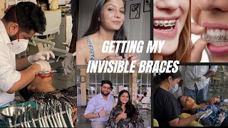 GETTING MY INVISIBLE ALIGNERS  CLEAR ALIGNERS [upl. by Ahseinek247]