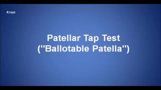 Patellar Tap test Ballotable Patella [upl. by Ilime]