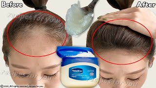 How to use Vaseline for double hair growth your hair will grow 3 times faster [upl. by Roswell]