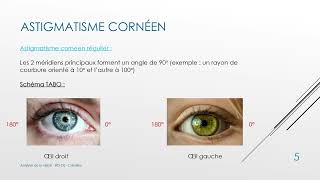 15 Cours Analyse de la Vision  Lastigmatisme de l’œil  BTS OL [upl. by Winifield]